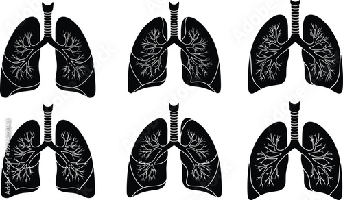 Detailed Human Lung Silhouette Vector Illustrations Set Featuring Respiratory System Anatomy Bronchial Tree and Trachea Isolated on White Background for Medical Healthcare 