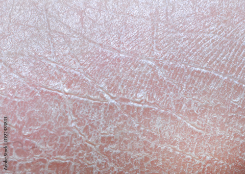 A close-up view of a fragment of dry human skin.