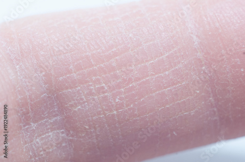 Close-up drawing of human skin.