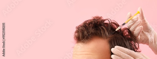 Young man with hair loss pr...