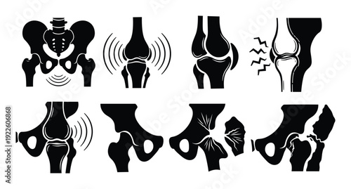 Bone joint pain problems and hip fracture anatomy vector illustrations