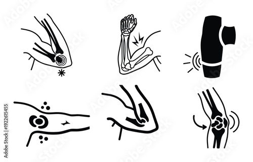 Joint pain and inflammation vector illustration set for medical use