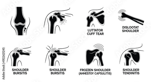 Shoulder and Knee Joint Injuries Vector Illustration Diagram