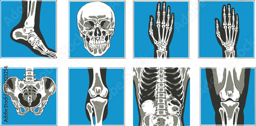A collection of eight x-ray images of the human skeletal system, including the ankle, skull, hand, pelvis, knee, spine, and arm on a blue background, showcasing various bones and joints.