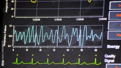 Modern patient monitor. Electronic Health Monitor displaying medical indicators and graphs of patient vital activity. Medical vital signs. Screen of computer monitor in hospital. Cardiogram ECG Pulse