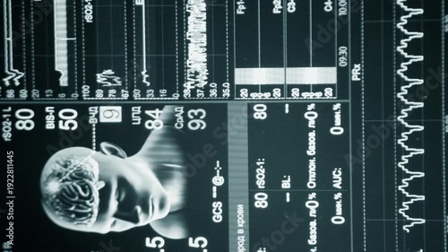 Modern patient monitor close-up. Electronic health monitor displaying medical indicators graphs of patient vital activity. Medical signs. Screen hospital computer monitor Cardiogram ECG Pulse Vertical