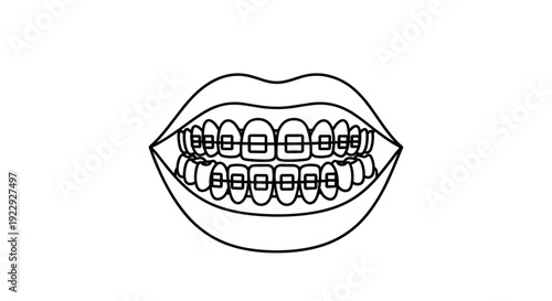 Close-up Of Teeth With Braces