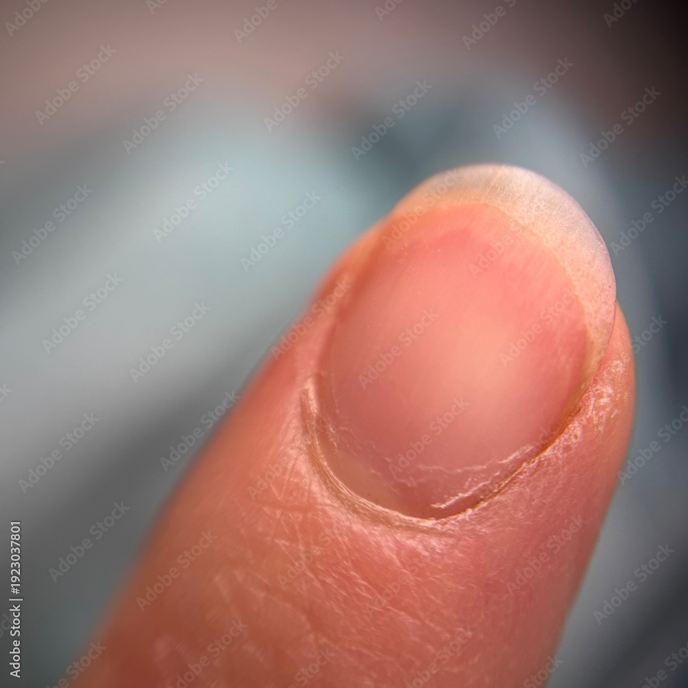 Fototapeta premium A macro shot of a human fingernail on a finger. body care, dermatology, physical health.