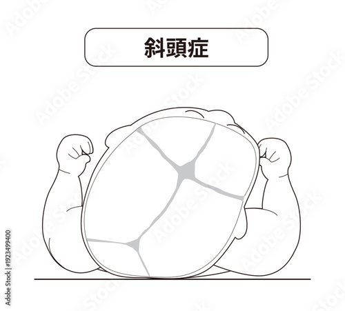 赤ちゃんが寝ている頭の向きによって頭の形に歪みが生じるメカニズム、斜頭症,短頭症,長頭症の赤ちゃんのイラスト