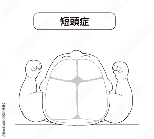 赤ちゃんが寝ている頭の向きによって頭の形に歪みが生じるメカニズム、斜頭症,短頭症,長頭症の赤ちゃんのイラスト