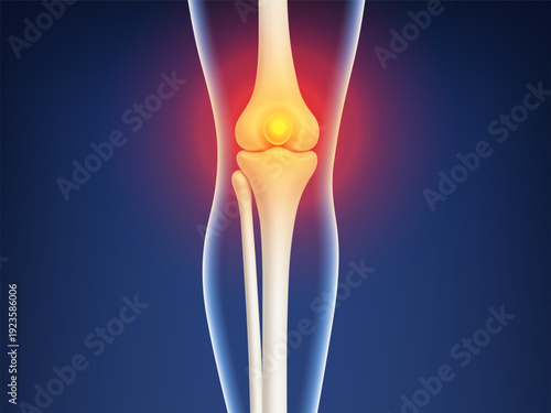 3D knee pain visualization. Leg bones with red inflammation glow at joint area. Biological and medical concept. Vector illustration