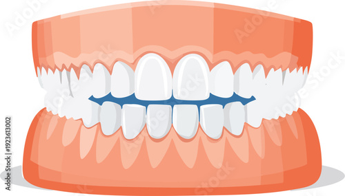 Denture complete set upper and lower, removable prosthesis symbol 