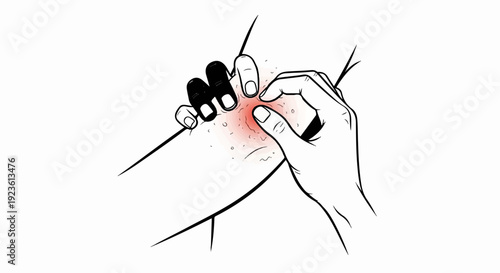 Close-up of fingers squeezing a red, inflamed pimple on skin