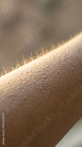 Skin displays goosebumps with light reflecting on hair follicles. Arm shown in outdoor setting with warm sunlight. Concept of human emotion, reactions, sensory perception
