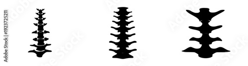 Elegant Spinal Silhouette: A Study in Anatomy