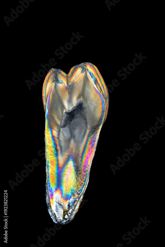 Canvas Print Human molar tooth thin slice 0,5 mm under cross polarized light, rainbow interfe