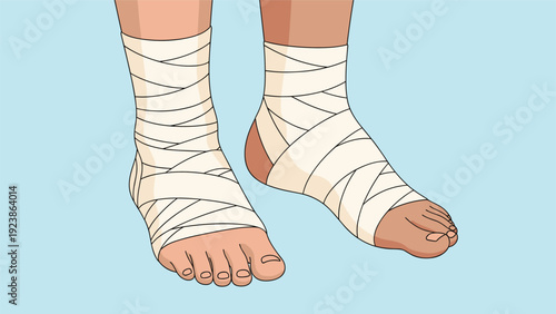 Medical illustration depicts a pair of human feet and ankles wrapped in white elastic bandages for injury support.