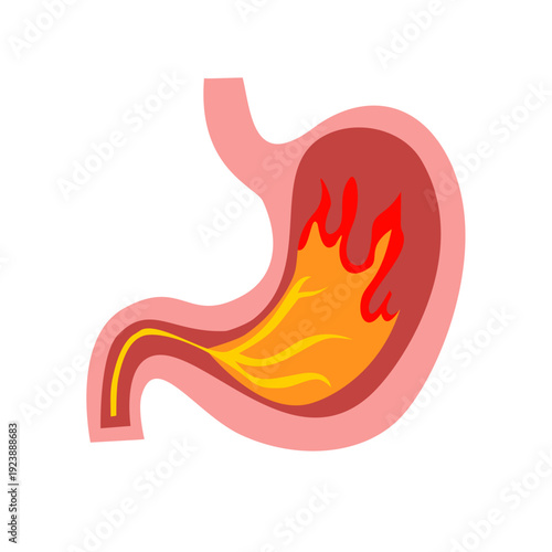 Stomach due to stomach ache, acid reflux. Gastritis concept vector illustration.