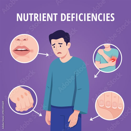 Common visual signs of nutrient deficiencies