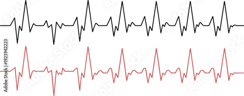 ECG heartbeat waveform graphics, medical electrocardiogram signals, red and black pulse lines, heart rhythm monitor illustration, healthcare diagnostic cardiology design