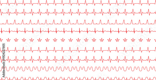 Red heartbeat ecg pulse line pattern for medical healthcare background
