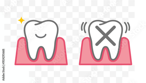 Healthy Tooth versus Unhealthy Tooth Illustration.