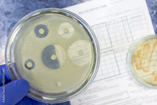 Fotografie An antibiotic efficacy test that shows large and small zones on a Petri dish where bacteria do not grow