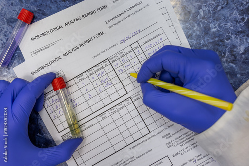 Photography Filling out a laboratory test report by the attending physician, the doctor holds a test tube with the patient's test sample and writes with a ballpoint pen, close-up from above