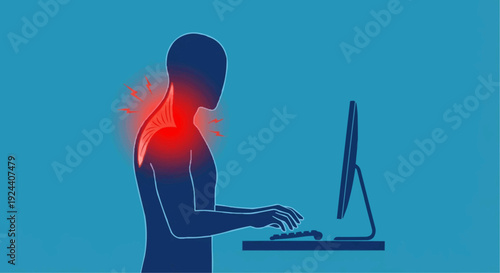 Upper shoulder muscle tension vector illustration with red pain area from typing at desk.