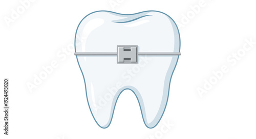 Anatomically correct white tooth with metal dental braces and a bracket, symbolizing orthodontics and dental care.