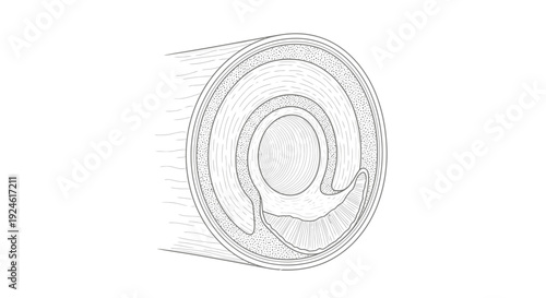 Cross-section of Atherosclerotic Artery with Plaque Buildup