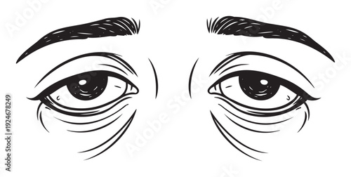 Depiction of human eyes showing extreme fatigue and dark circles under the eyelids, useful for illustrating concepts of stress, sleeplessness, or physical exhaustion in various media.
