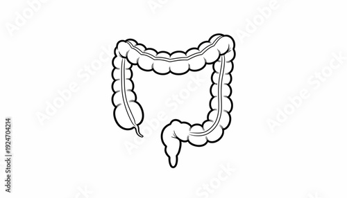 Colon Anatomy Illustration: Large Intestine Medical Diagram