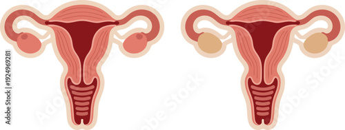 Anatomical diagrams show the female reproductive system with ovaries featuring normal and cystic structures