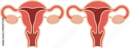 Two detailed medical illustrations display the healthy internal female reproductive organs and their structure
