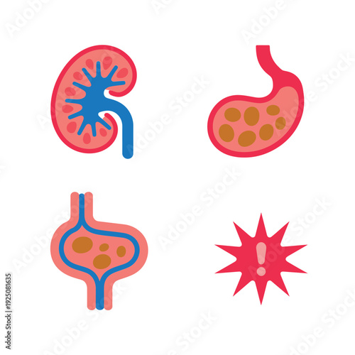 Gastrointestinal and renal disorder set, stomach ulcer, kidney stone hazard, urinary tract pathway, patient education poster, clinic triage session