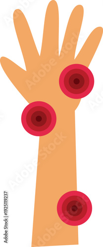 Human arm indicating painful inflamed areas with concentric red circles