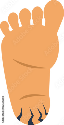 Vector illustration of a human foot with cracked dry heel highlighting skin damage problems
