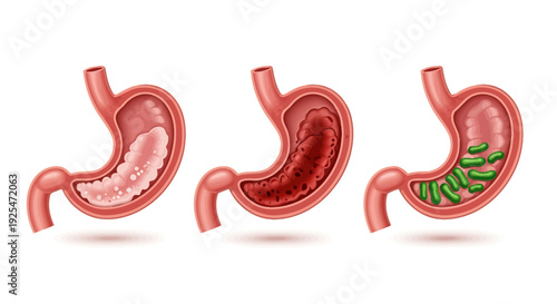 Crosssection of Human Stomach Showing Different Stages of Digestion.