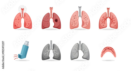 Illustration of Healthy and Diseased Lungs and Asthma Inhaler.