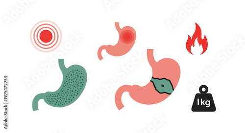 Illustration of Stomach Health Issues and Symptoms.