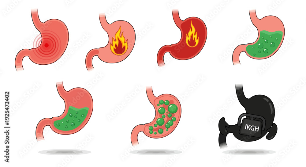 Fototapeta premium Stomach Health and Digestive Issues A Comprehensive Visual Guide to Gastric Conditions.