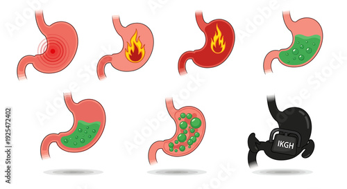 Stomach Health and Digestive Issues A Comprehensive Visual Guide to Gastric Conditions.