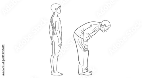 Human Body Posture Illustration Standing Bent.