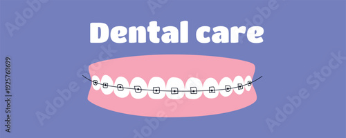 Dental Care Poster with Teeth in Braces, Orthodontic Treatment Concept Vector Illustration