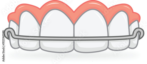 Dental retainer hawley illustration isolated on brown background