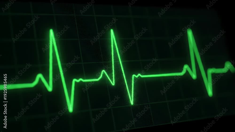 Heartbeat Monitor Displaying Green EKG Waveform on Grid Background ...