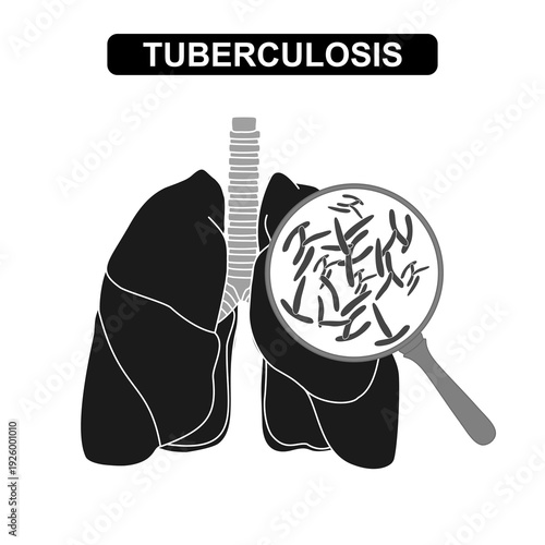 Pulmonary Tuberculosis concept with Mycobacterium Under Magnification, lung disease concept. Flat symbol vector for, health element design, medical awareness campaign, education, and medical poster
