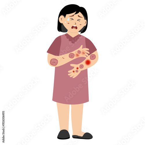 Woman suffering from a skin rash. Distressed woman from a severe skin rash, allergies, and eczema.