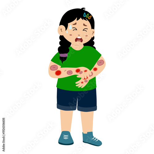 Little kid suffering from a skin rash. Distressed kid from a severe skin rash, allergies, and eczema.
